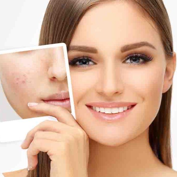 Tratamientos dermatológicos